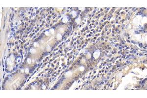 Detection of CDK2AP1 in Human Small intestine Tissue using Polyclonal Antibody to Cyclin Dependent Kinase 2 Associated Protein 1 (CDK2AP1) (CDK2AP1 抗体  (AA 1-115))