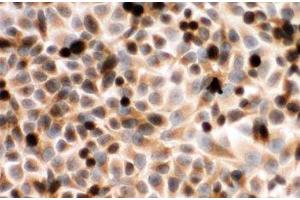 ICC testing of CYPOR antibody and human placenta cells (POR 抗体  (C-Term))