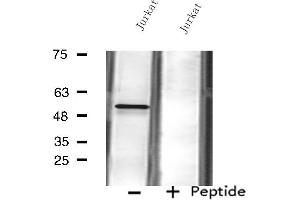 Western blot analysis of extracts from Jurkat cells using FKRP antibody. (FKRP 抗体  (N-Term))
