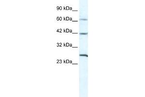 WB Suggested Anti-GJC1 Antibody Titration:  5. (GJC1 抗体  (N-Term))