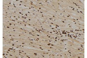 ABIN6263047 and ABIN6276556 at 1/100 staining Rat heart tissue by IHC-P.