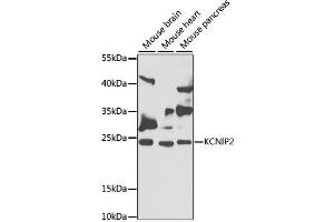 Western blot analysis of extracts of various cell lines, using KCNIP2 antibody (ABIN2563522) at 1:1000 dilution. (KCNIP2 抗体)