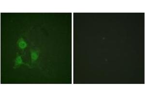 Immunofluorescence analysis of A549 cells, using PKA CAT (Phospho-Thr197) Antibody. (PKA CAT (AA 166-215), (pThr198) 抗体)