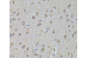 Immunohistochemistry of paraffin-embedded Mouse brain using NME1 Polyclonal Antibody at dilution of 1:200 (40x lens). (NME1 抗体)