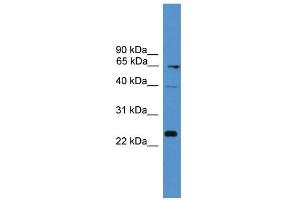 WB Suggested Anti-CD7 Antibody Titration: 0. (CD7 抗体  (Middle Region))