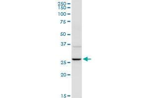 UROS MaxPab rabbit polyclonal antibody. (UROS 抗体  (AA 1-265))