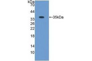 Detection of Recombinant PKCb1, Rabbit using Polyclonal Antibody to Protein Kinase C Beta 1 (PKCb1) (Pkc beta 1 抗体  (AA 342-600))