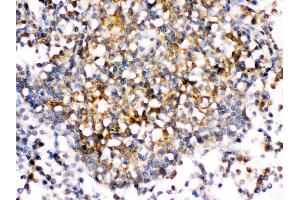 CD153 was detected in paraffin-embedded sections of human tonsil tissues using rabbit anti- CD153 Antigen Affinity purified polyclonal antibody at 1 μg/mL.