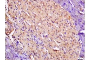 Immunohistochemistry (Paraffin-embedded Sections) (IHC (p)) image for anti-CTD (Carboxy-terminal Domain, RNA Polymerase II, Polypeptide A) Small Phosphatase 2 (CTDSP2) (AA 25-150) antibody (ABIN2559702)