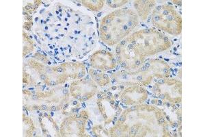 Immunohistochemistry of paraffin-embedded Rat kidney using DCP2 Polyclonal Antibody at dilution of 1:100 (40x lens). (DCP2 抗体)