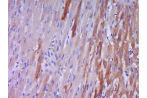 Paraformaldehyde-fixed, paraffin embedded rat heart muscle Antigen retrieval by boiling in sodium citrate buffer (pH6. (Prepro-Endothelin-1 (AA 16-110) 抗体)