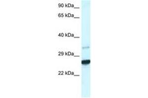 Image no. 1 for anti-Caudal Type Homeobox 1 (CDX1) (AA 195-244) antibody (ABIN6747429) (CDX1 抗体  (AA 195-244))