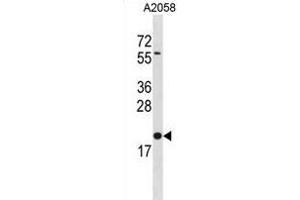 BLOC1S3 Antibody (C-term) (ABIN1881114 and ABIN2838858) western blot analysis in  cell line lysates (35 μg/lane). (BLOC1S3 抗体  (C-Term))