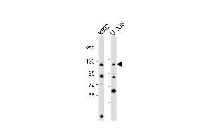 All lanes : Anti-NOP2 Antibody (N-Term) at 1:2000 dilution Lane 1: K562 whole cell lysate Lane 2: U-2OS whole cell lysate Lysates/proteins at 20 μg per lane. (Nucleolar Protein 1 (NOL1) (AA 9-43) 抗体)