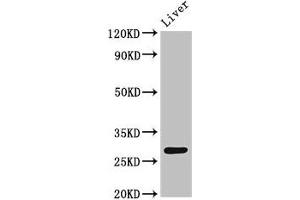 Western Blot Positive WB detected in: Rat liver tissue All lanes: CDX1 antibody at 4 μg/mL Secondary Goat polyclonal to rabbit IgG at 1/50000 dilution Predicted band size: 29, 15 kDa Observed band size: 29 kDa (CDX1 抗体  (AA 206-245))