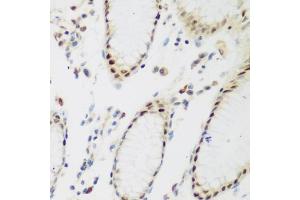 Immunohistochemistry (IHC) image for anti-Peter Pan Homolog (PPAN) (AA 1-300) antibody (ABIN6145994)