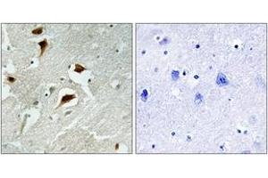 Immunohistochemistry (IHC) image for anti-Eukaryotic Translation Initiation Factor 4E Binding Protein 1 (EIF4EBP1) (AA 35-84), (pThr69) antibody (ABIN1531251)