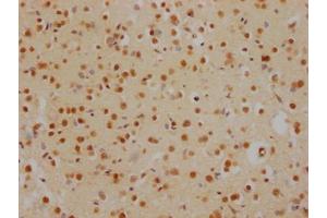IHC image of ABIN7127538 diluted at 1:100 and staining in paraffin-embedded human brain tissue performed on a Leica BondTM system. (Recombinant HDAC2 抗体)