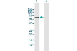 Western Blot analysis of MAOA expression in transfected 293T cell line by MAOA MaxPab polyclonal antibody. (Monoamine Oxidase A 抗体  (AA 1-527))
