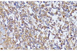 Immunohistochemistry of paraffin-embedded Human tonsil using STK24 Polyclonal Antibody at dilution of 1:100 (40x lens). (STK24 抗体)