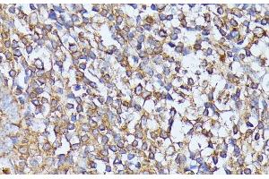 Immunohistochemistry of paraffin-embedded Human tonsil using STK24 Polyclonal Antibody at dilution of 1:100 (40x lens). (STK24 抗体)