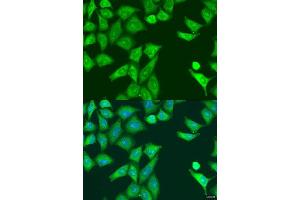Immunofluorescence analysis of U2OS cells using EIF2AK2 antibody. (EIF2AK2 抗体  (AA 1-270))