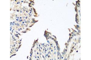 Immunohistochemistry of paraffin-embedded Human lung using GPI Polyclonal Antibody at dilution of 1:100 (40x lens). (GPI 抗体)