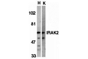 Western Blotting (WB) image for anti-Interleukin-1 Receptor-Associated Kinase 2 (IRAK2) antibody (ABIN1030204) (IRAK2 抗体)