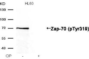 Western blot analysis of extracts from HL60 cells, treated with calf intestinal phosphatase (CIP), using Zap-70 (Phospho-Tyr319) Antibody. (ZAP7 (pTyr319) 抗体)