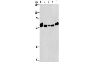 Gel: 8 % SDS-PAGE, Lysate: 40 μg, Lane 1-5: Mouse liver tissue, Raji cells, hela cells, hepG2 cells, A549 cells, Primary antibody: ABIN7128790(CAT Antibody) at dilution 1/266. (Catalase 抗体)