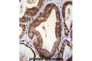 Immunohistochemistry (IHC) image for anti-SHQ1 Homolog (SHQ1) antibody (ABIN2996338) (SHQ1 抗体)