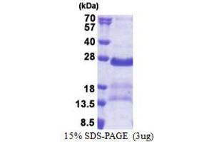 SDS-PAGE (SDS) image for G Antigen 2A (GAGE2A) (AA 1-116) protein (His tag) (ABIN5853252) (G Antigen 2A Protein (GAGE2A) (AA 1-116) (His tag))