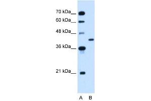 GOT2 antibody used at 2. (GOT2 抗体)