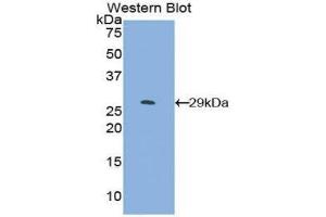 Western Blotting (WB) image for anti-SMAD Family Member 4 (SMAD4) (AA 323-552) antibody (ABIN1860591) (SMAD4 抗体  (AA 323-552))