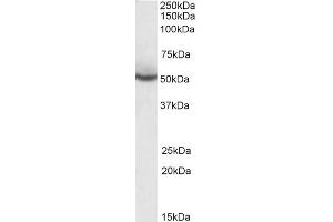 ABIN185282 (0. (PPARD 抗体  (C-Term))