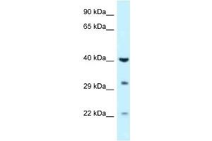 Western Blot showing GALK1 antibody used at a concentration of 1 ug/ml against Fetal Liver Lysate (GALK1 抗体  (C-Term))