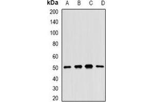 Western blot analysis of MKK5 expression in H460 (A), BT474 (B), mouse liver (C), rat kidney (D) whole cell lysates. (MAP2K5 抗体)