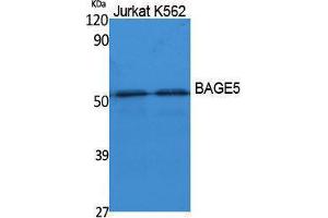 Western Blotting (WB) image for anti-B Melanoma Antigen Family, Member 5 (BAGE5) (N-Term) antibody (ABIN3187625) (BAGE5 抗体  (N-Term))