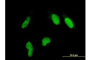 Immunofluorescence of monoclonal antibody to GLTSCR2 on HeLa cell. (GLTSCR2 抗体  (AA 402-478))