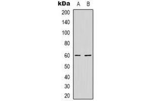 Western blot analysis of NXF3 expression in HepG2 (A), MCF7 (B) whole cell lysates.