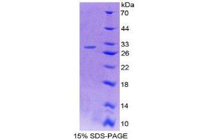 SDS-PAGE (SDS) image for Protein tyrosine Phosphatase, Receptor Type, H (PTPRH) (AA 685-909) protein (His tag) (ABIN2126545) (PTPRH Protein (AA 685-909) (His tag))