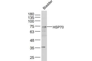 Mouse bladder lysates probed with HSP70 Polyclonal Antibody, Unconjugated  at 1:300 dilution and 4˚C overnight incubation. (HSP70 抗体  (AA 481-534))