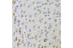 Immunohistochemistry of paraffin-embedded rat brain using BTD antibody (ABIN5973709) at dilution of 1/100 (40x lens). (BTD 抗体)