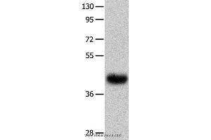 Western blot analysis of Human fetal muscle tissue  , using UTS2R Polyclonal Antibody at dilution of 1:400 (UTS2R 抗体)