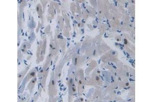 Used in DAB staining on fromalin fixed paraffin- embedded heart tissue (TOP3B 抗体  (AA 1-250))