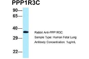 Host: Rabbit  Target Name: PPP1R3C  Sample Tissue: Human Fetal Lung  Antibody Dilution: 1. (PPP1R3C 抗体  (N-Term))