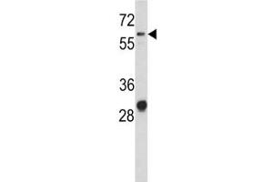 Western Blotting (WB) image for anti-Activated Leukocyte Cell Adhesion Molecule (ALCAM) (AA 58-87) antibody (ABIN3029841)