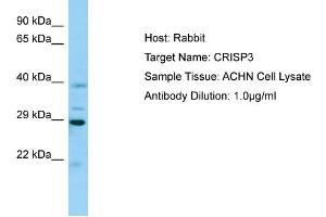 Western Blotting (WB) image for anti-Cysteine-Rich Secretory Protein 3 (CRISP3) (N-Term) antibody (ABIN2789796) (CRISP3 抗体  (N-Term))