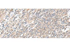 Immunohistochemistry of paraffin-embedded Human tonsil tissue using WDR47 Polyclonal Antibody at dilution of 1:35(x200) (WDR47 抗体)
