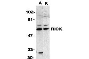 Western Blotting (WB) image for anti-Receptor-Interacting Serine-threonine Kinase 2 (RIPK2) (N-Term) antibody (ABIN1031540) (RIPK2 抗体  (N-Term))